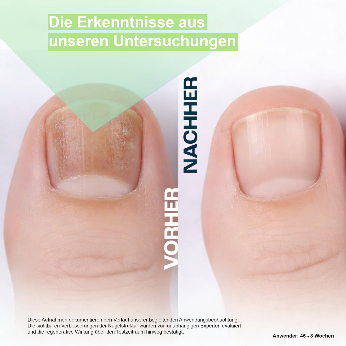 Nail Care Pen – Für starke & gesunde Nägel